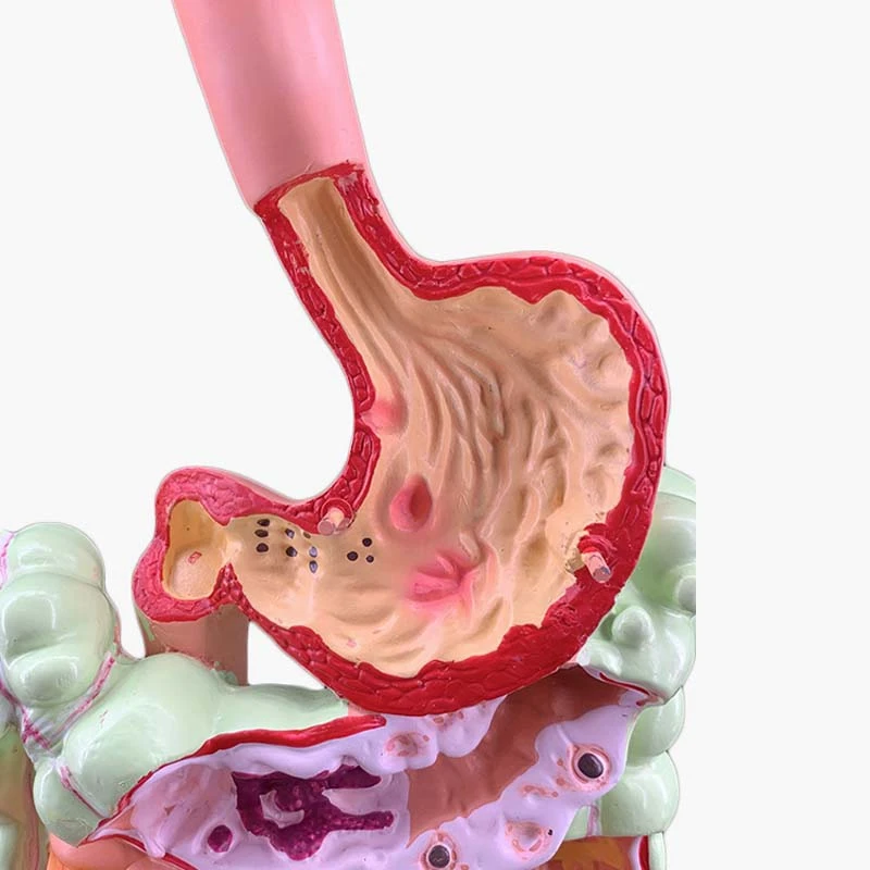 Model ludzkiego układu trawiennego anatomia żołądka jelito grube jelita ślepe odbytnicy dwunastnicy Model struktury ludzkich narządów wewnętrznych