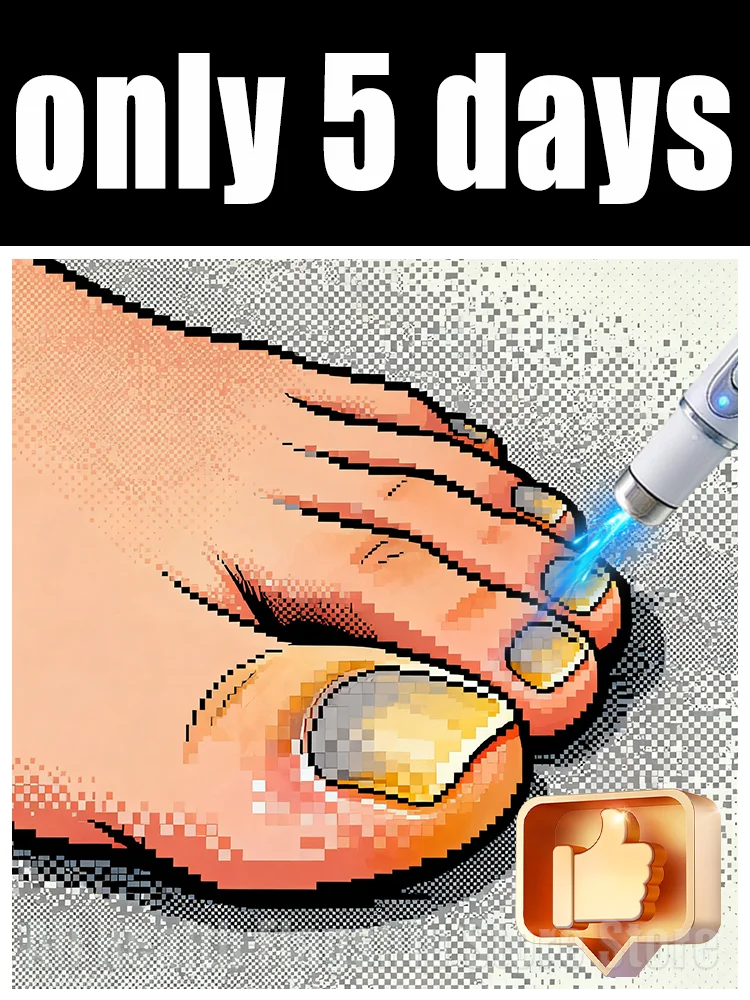 

The fifth generation of champagne-colored nail laser penʜᴇʟᴘs ʏᴏᴜ sᴀʏ ɢᴏᴏᴅʙʏᴇ ᴛᴏ ᴏɴʏᴄʜᴏᴍʏᴄᴏsɪs. Tᴇᴄʜɴᴏʟᴏɢʏ ᴄʜᴀɴɢᴇs ʏᴏᴜʀ ʟɪharᴇ。