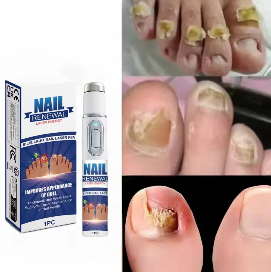 

Boliseurrafo너피피 con luz azul que man Baş un cuerpo sano.