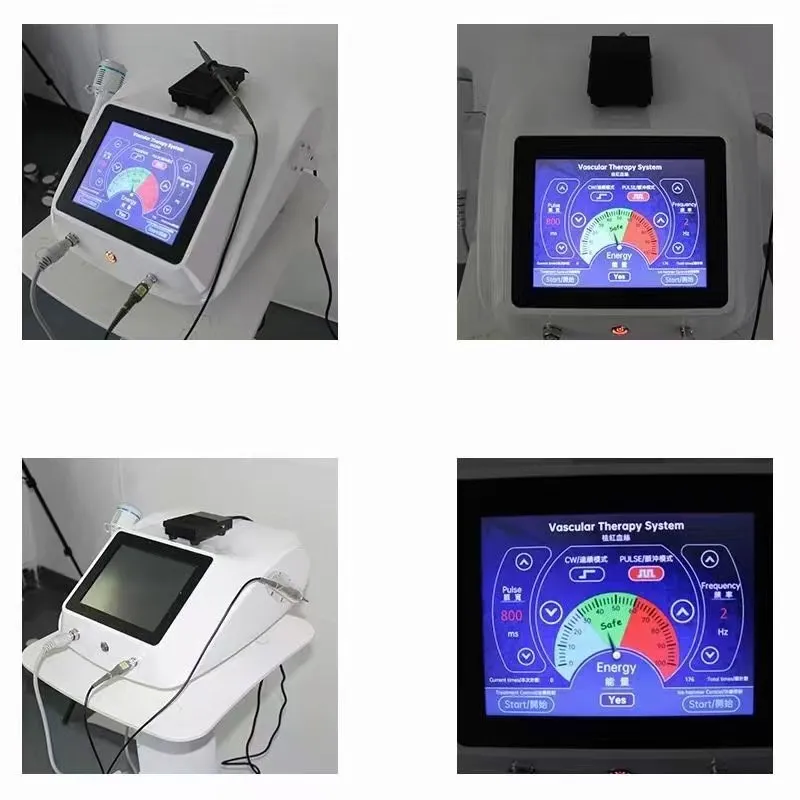 

High Frequency Needle RF Spider Vein Removal Anti-Redness Beauty Equipment Vascular Spots Treatment Machine for Red Blood Vessel