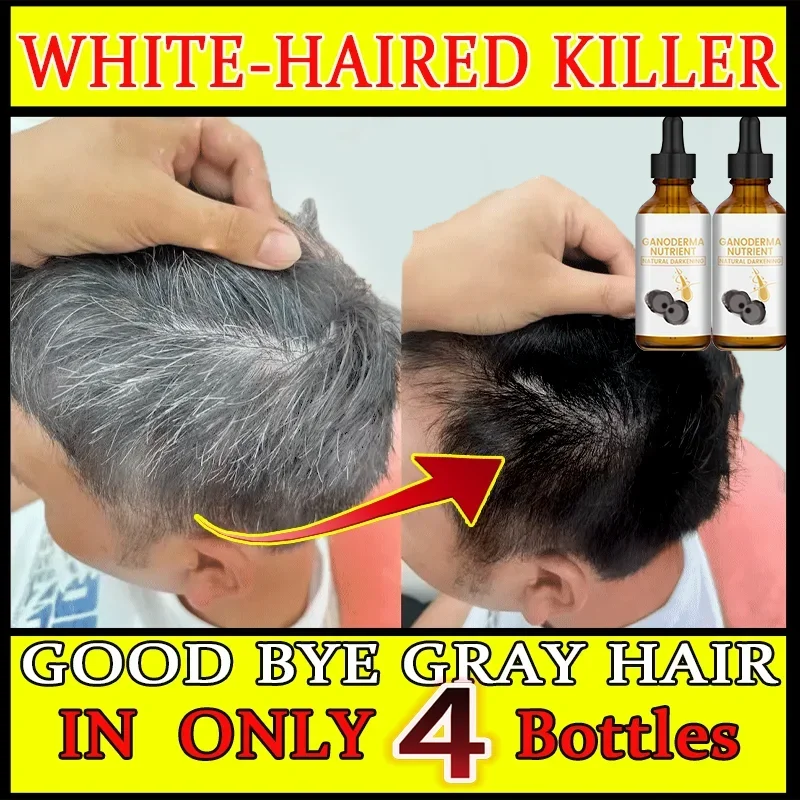 White Hair Care - Grey hair Serum White hairs essence Anti-gray hair, regrow black hairSerum White hairs essence black hair