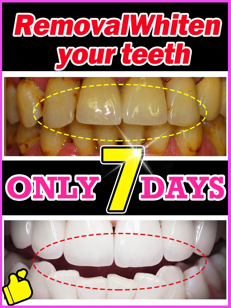 

Rapid Teeth Whitening Effectively beautifies teeth and relieves tooth damage