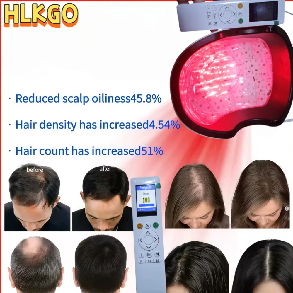 

Professional Hair Regrowth Helmet, 6750mW 300 Beam Laser Therapy Cap (90+210) Anti Hair Loss Device, Remote Adjustable for Treat