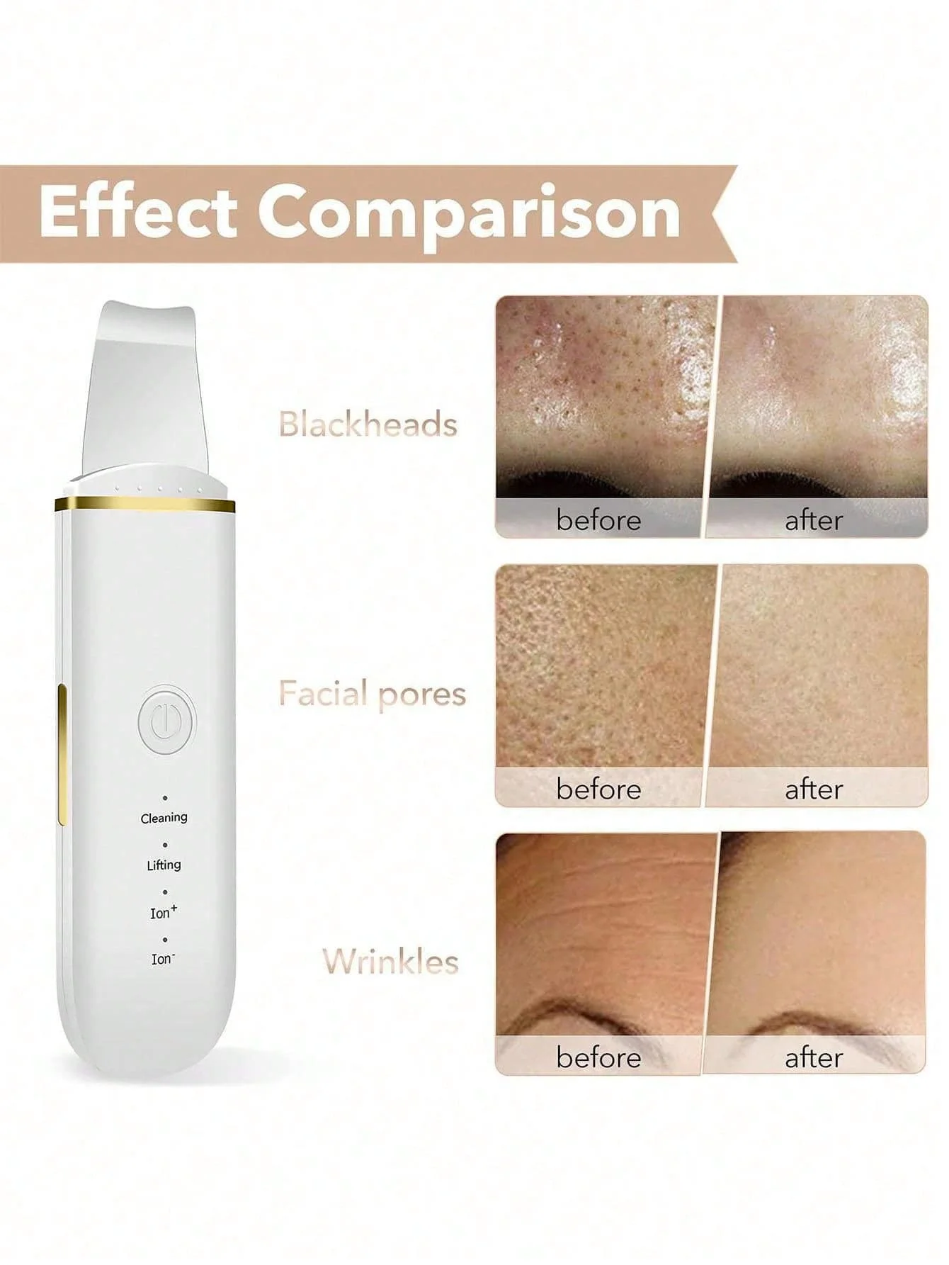 Raschietto per il viso, detergente per i pori, strumento per la rimozione dei punti neri, utilizzato per la pulizia profonda del viso e la cura della pelle, preferito come regalo.