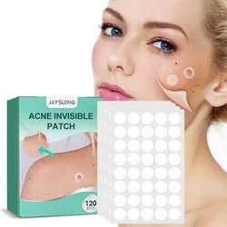 120 Stuks Onzichtbare Acne Puistje Patch Professionele Gezicht Huidverzorging Reparatie Acne Healing Absorberende Spot Sticker Voor Mannen Vrouwen