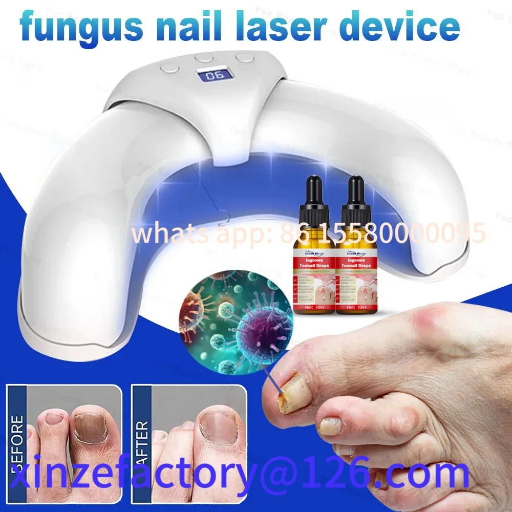 

Customizable Fungal Nail Laser Device Repair Fast Nails Fungus Onychomycosis Repair Toenail Fingernail