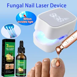 Fungal Nail Laser Device Repair Toenail Nails Fungus Onychomycosis Essence Repair Toenail Fingernail Removes Nail Fungus Care