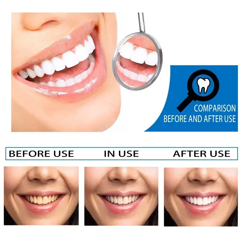 Cleaning Tooth Whitening Serum Effective Remove Plaque Serum Yellow Teeth Tooth Stains Removal Serum Fresh Breath Toothpaste