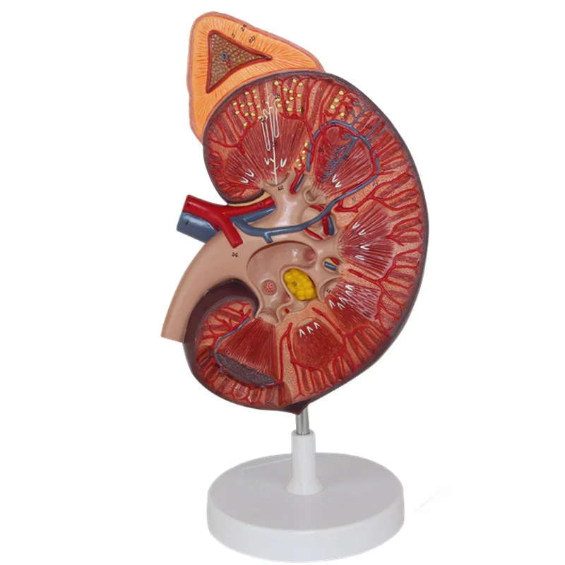 Human kidney anatomy model kidney belt adrenal gland model urology nephrology doctor-patient communication models