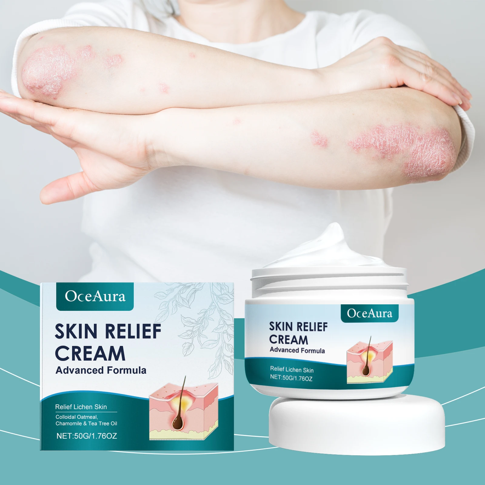

OceAura Hair Follicle Care Cream Care Scalp Back Face Clean Repair Acne Hair Follicle Care Cream 1pcs