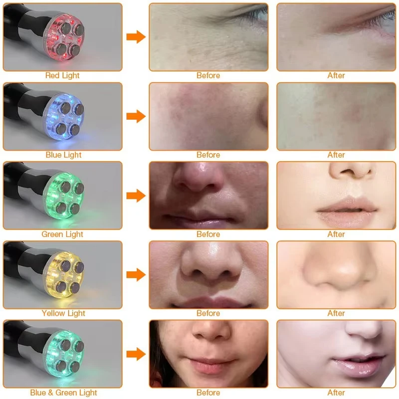 جهاز تجميل الوجه RF مع 5 علاج بالضوء LED لشد الجلد وشد الوجه وأداة مكافحة الشيخوخة لروتين العناية بالبشرة المنزلية #5