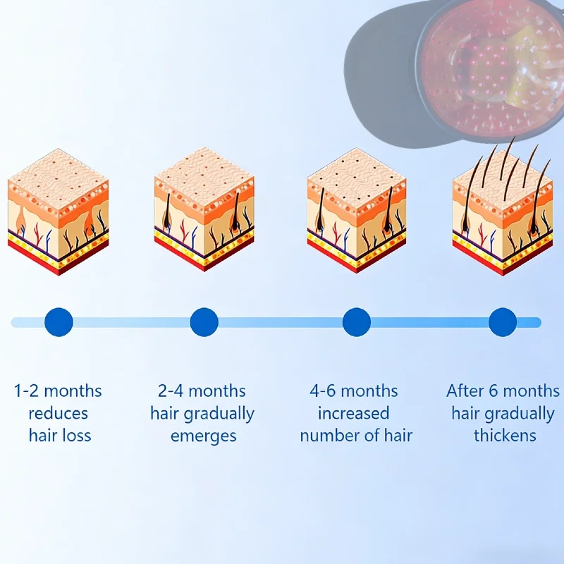 

Профессиональный лазерный шлем LLLT 650 нм, устройство для восстановления роста волос и эффективной активации волосяных фолликулов