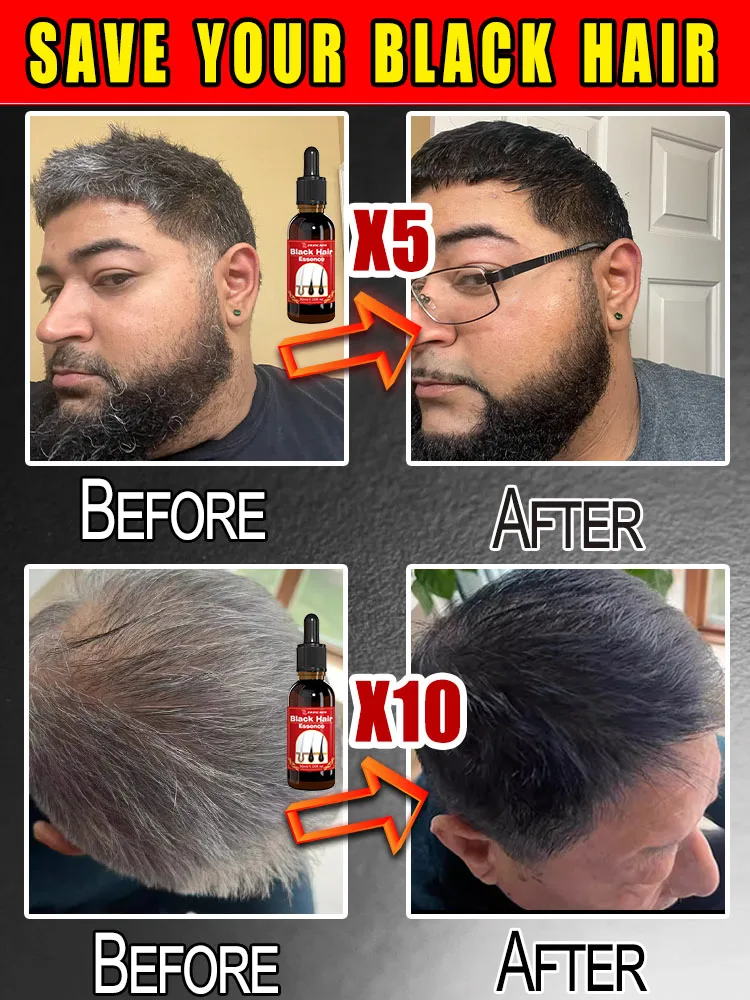 30ml Hair Color Miracle – See White Hair Turn Black in Just 7 Days