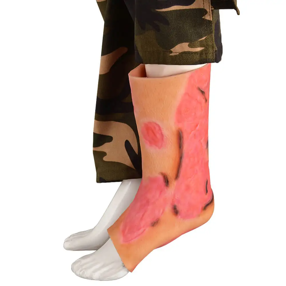 

Severe Ankle & Lower Leg Burn Simulation Sleeve