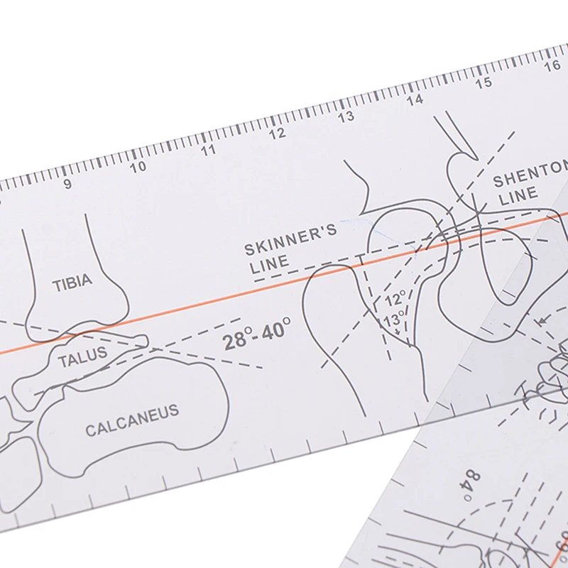 Multi-Ruler Goniometer Angle Medical Ruler Joint Orthopedics Tool Instruments