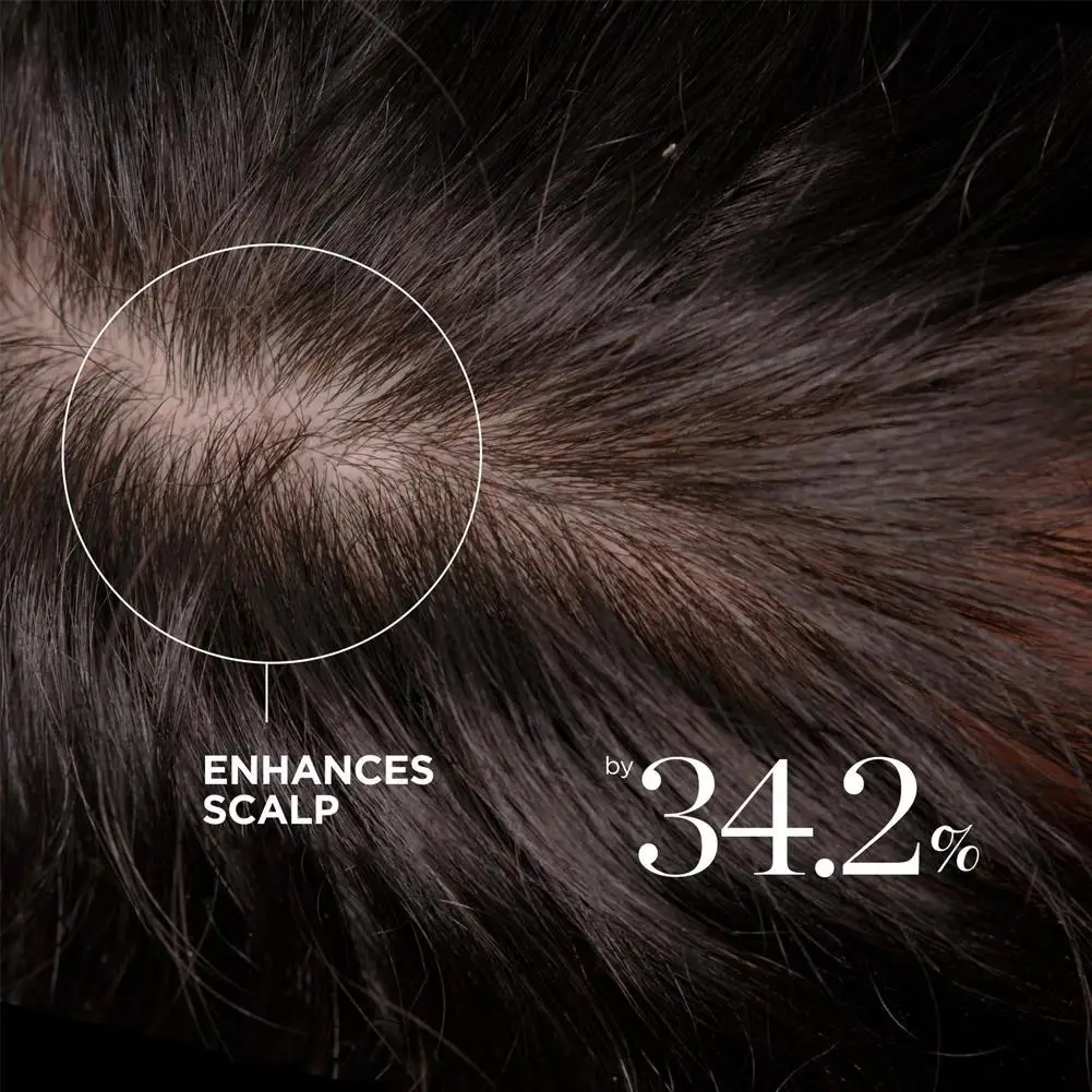Dr. Groot Revitalisierende Lösung - Reinigendes Shampoo, Haarverdichtender Conditioner, Kopfhautpflege-Essenzöl, Tiefenwirksame Feuchtigkeitspflege – Detail 16