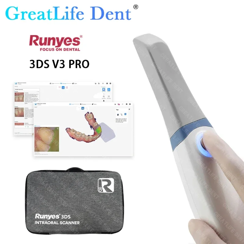 Runyes 3D Intraoral Scanner Original Dental AI Scanning Support Languages for Digital Implant/Orthodontics/Restoration