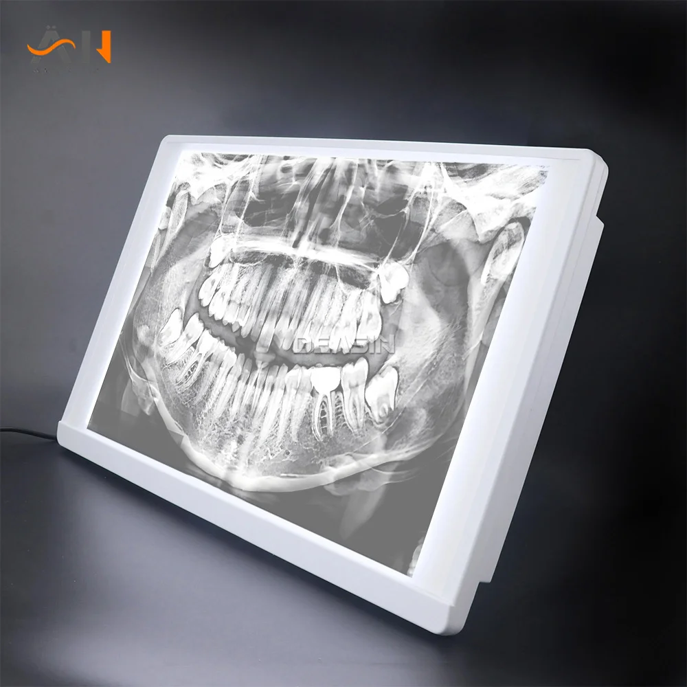 

Big size Dental Equipment X-Ray Film Illuminator Light Box X-ray Viewer Light Panel Screen with Bracket Chip for Dental Lab
