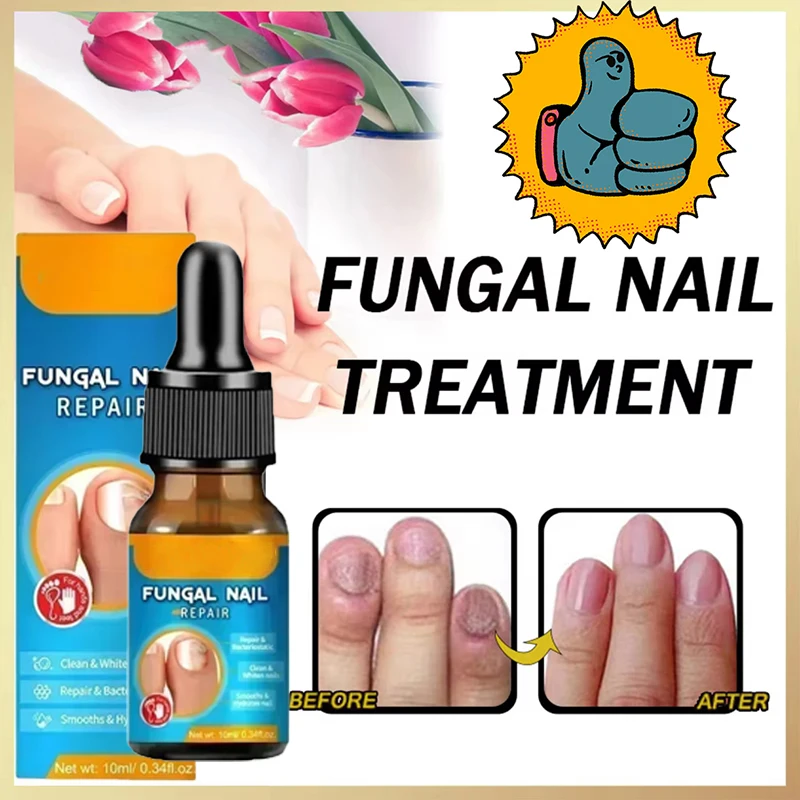 Fungal Nail Removal 10ML Fungal Nail Treatment Oil Foot Repair Essence Toe Nail Fungus Removal Gel Anti Infection Cream