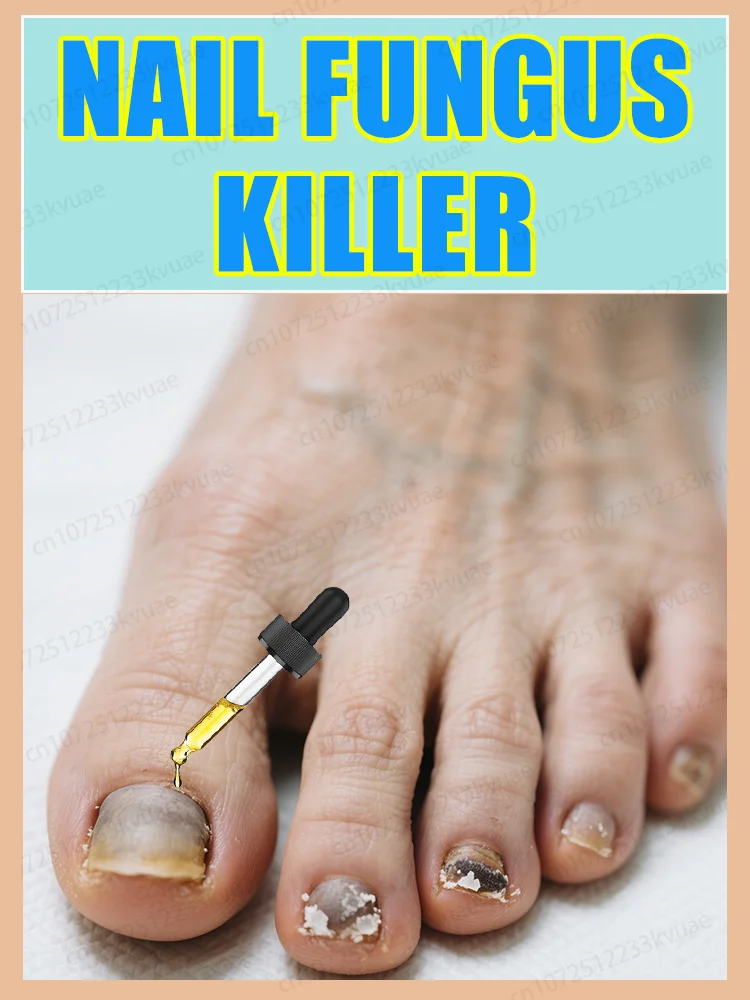 Qᴜɪᴄᴋʟʏ ᴛʀᴇᴀᴛ ғᴜɴɢᴀʟ ɪɴғᴇᴄᴛɪᴏɴs protéger les ongles contre les bactéries et garder vos ongles propres comme neuf