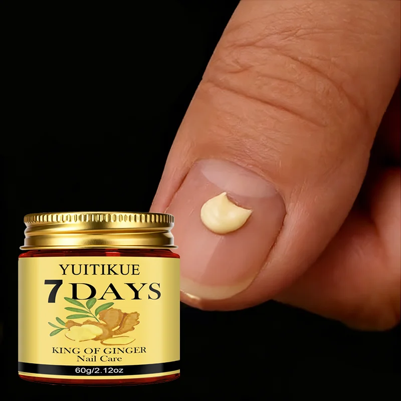 

YUITIKUE 7Days Ginger King Nail Care Cream - 7-Day Results, Sterilize & Renew Nails, for Healthy Beautiful Nails 60g
