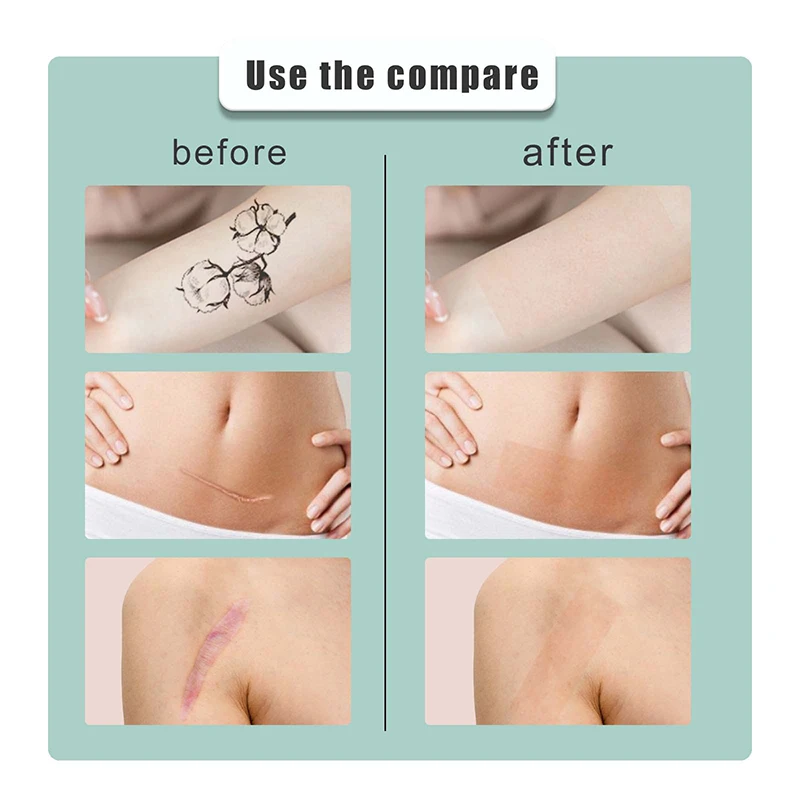 Full Cover Sticker Practical Tattoo Flaw Conceal Tape Waterproof Cover Scar Suitable For Any Skin Type Flaw Concealing Tape