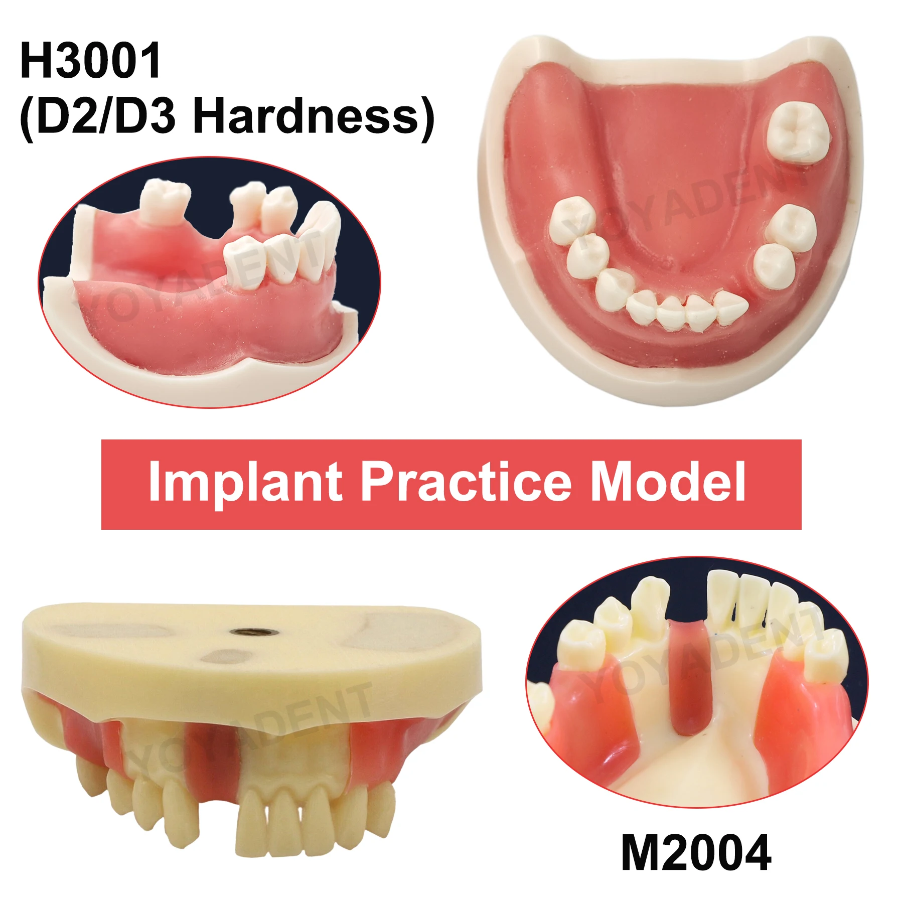 

Dental Implant Model Soft Gum Perforated Implant Demonstration Student Training Model Dental Product Teaching