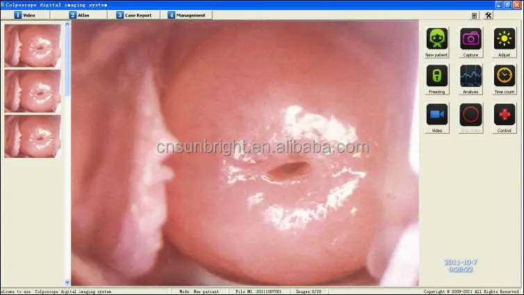 thumb