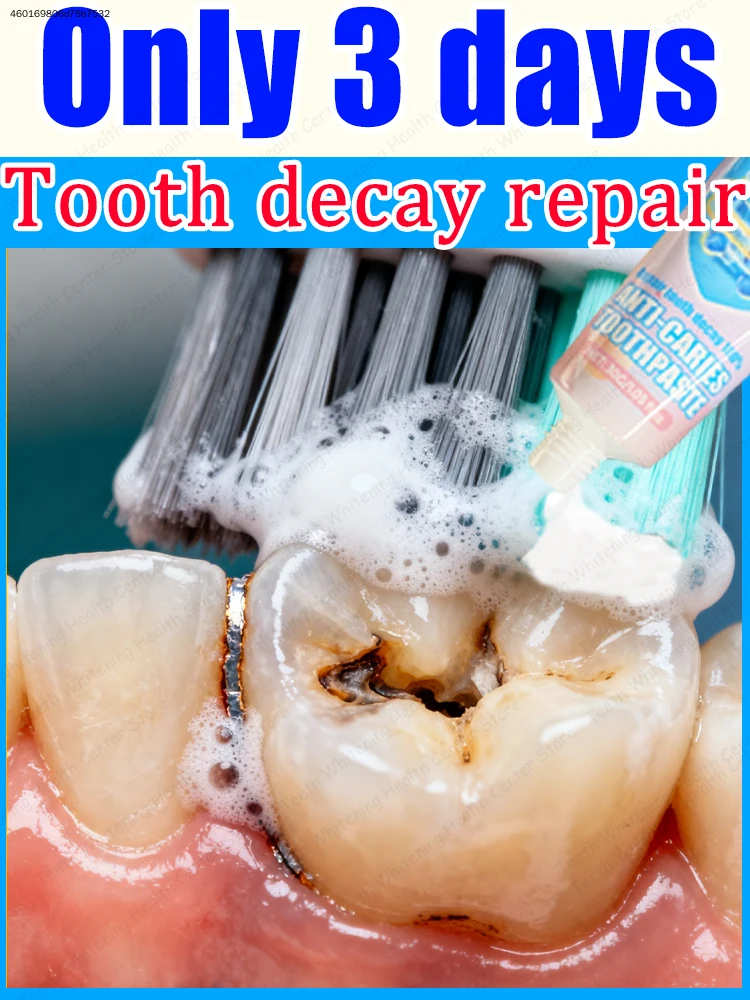 Effective oral cleaning and ᴛᴏᴏᴛʜ ʀᴇᴘᴀɪʀ ɪɴ 3 ᴅᴀʏs
