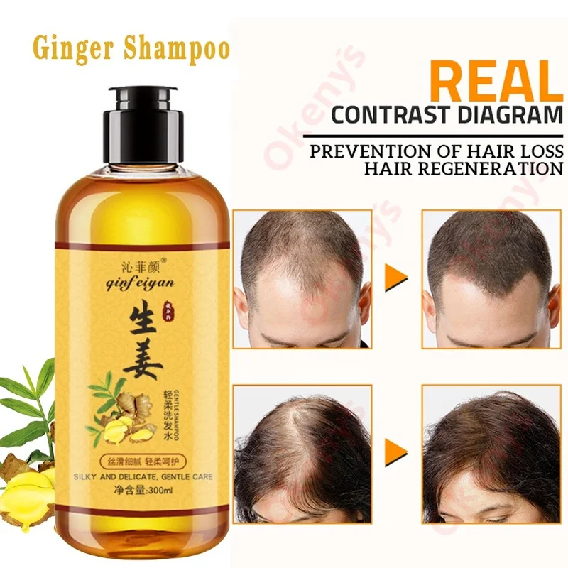 Genuine Professional Hair Ginger Shampoo 300ml Hair Regrowth Dense Fast Thicker Hair Growth Shampoo Anti Hair Loss Product