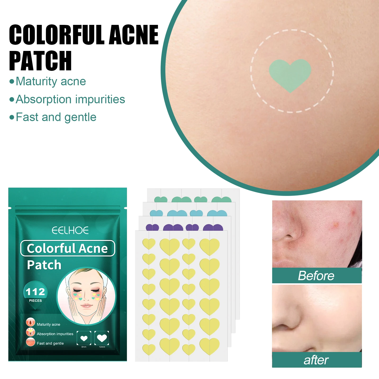 EELHOE Love Heart Pimple Patch Acne Bumps Patch Gentle Cleansing Pimple Patch Fade Face Pimple Marks Spots Facial Care Tools