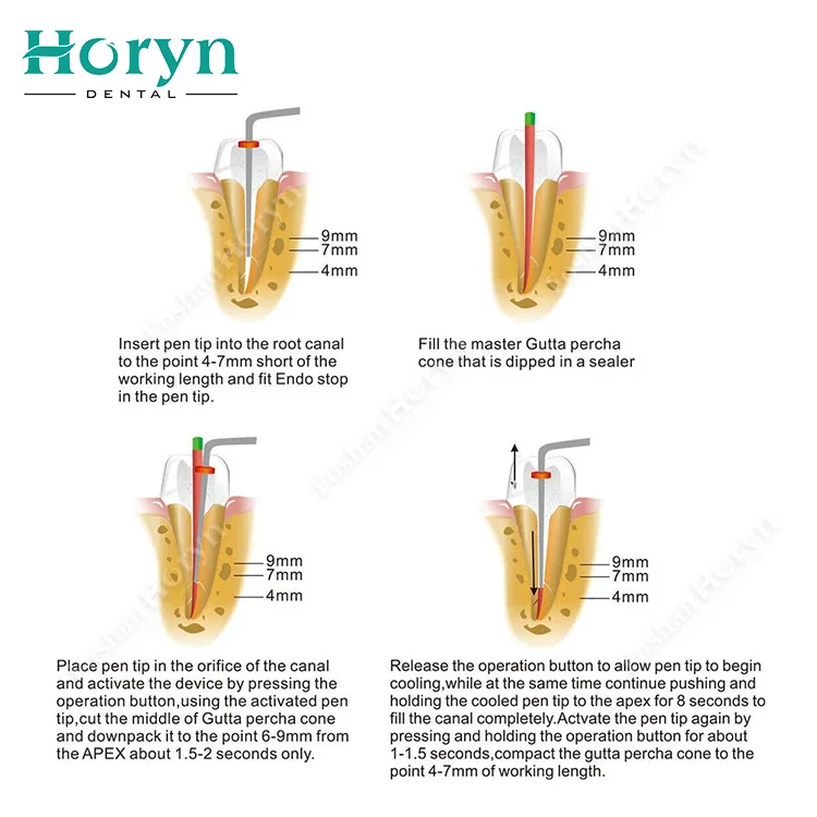 Rapid Heating den tal Cordless Gutta Percha Beheiztes Stiftobturationssystem mit 4 Spitzen