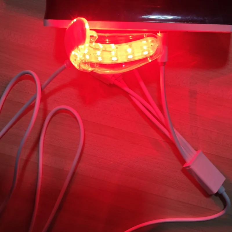 

Professional Oral Therapy Device Red Light Treatment for Immediate Tooth Pain Gum Sensitivity Relief