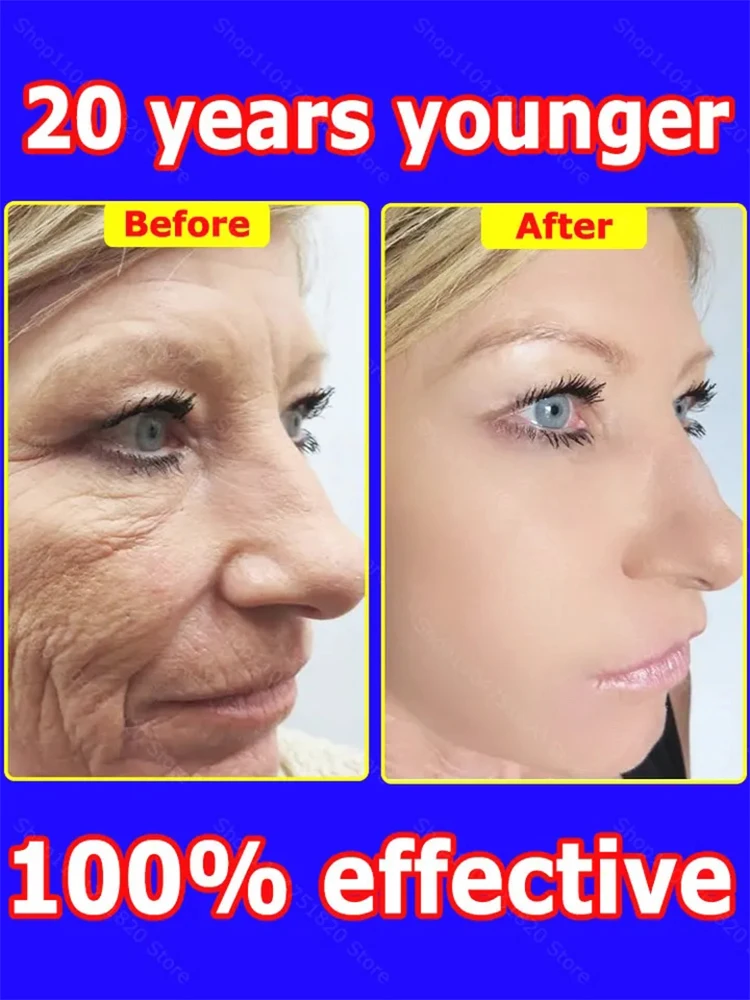 

bubbles skincare Wrinkle removal cream Anti-wrinkle facial cream facial lifting care massagersFacial Wrink beauty-health Remove