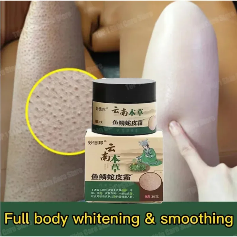 Remove Thick Pores Body Dark Spot Moisturize Smooth Skin Care New Chicken Skin Repair Cream Curing Keratosis Follicle Pilaris