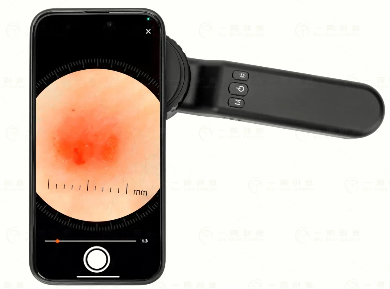 IBOOLO DE-4100 Medical Instruments Dermatoscope 10X Magnification Home Use Compatible with Phone