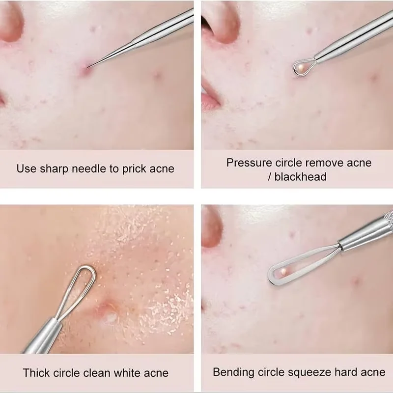 4 stks/8 stks/set Facial Pore Cleaner Lepel Mee-eter Comedo Acne Puistje Comedondrukker Tool Naalden Voor Gezicht huidverzorging Tool