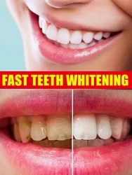 Whitening Toothpaste Remove Stains Reduce Yellowing Care For Teeth Gums Fresh Breath Brightening Teeth