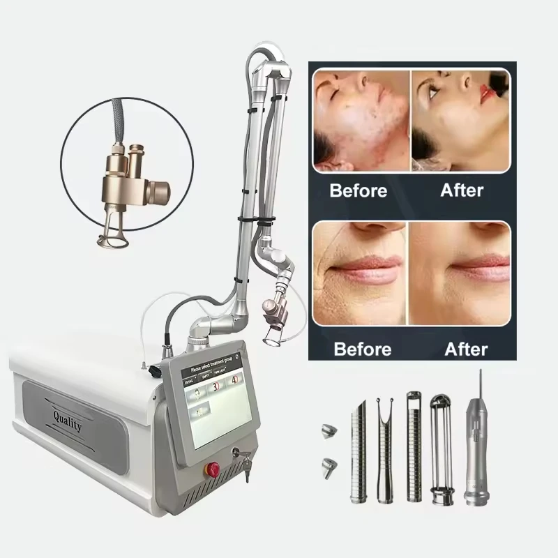 CO2 Fractional        Skin Resurfacing Machine – Por      Scar & Pigment Removal Device