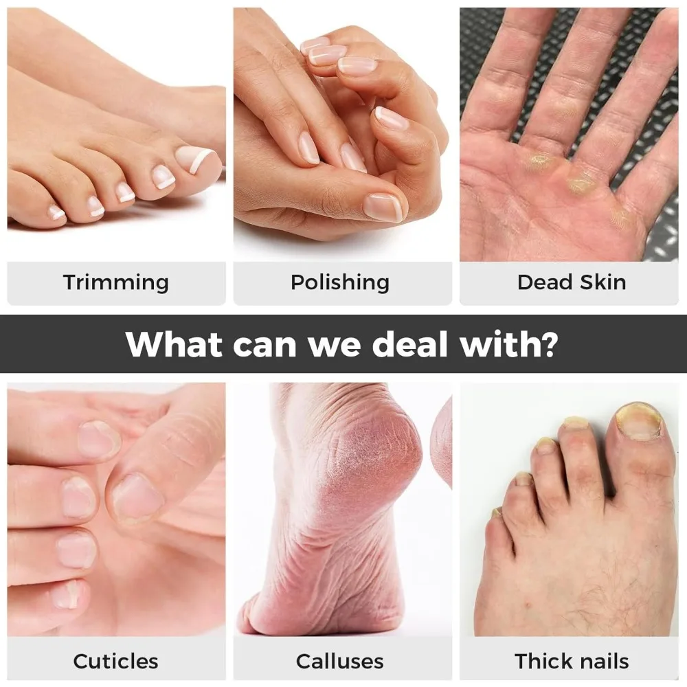 Kit profesional de manicura y pedicura, herramientas de pedicura para pies, juego de lima de uñas con taladro eléctrico, herramientas para manos y pies y uñas