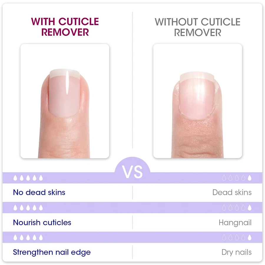 QAZIXU 10ml 네일 케어 큐티클 리무버 네일 폴리쉬 각질 제거 젤 매니큐어 트리트먼트 도구 네일 아트 DIY 살롱 홈용