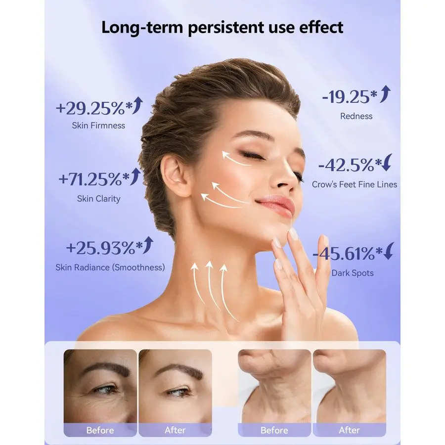 العلاج بالضوء للوجه، قناع الوجه LED العلاج بالضوء، 630 نانومتر أمبير 830 نانومتر الطول الموجي LED جهاز العلاج بالضوء للاستخدام المنزلي الداكن #3