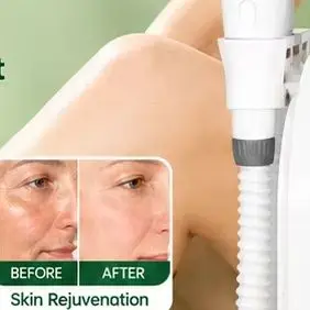 7000W 4 in 1 Diode Laser Hair Removal Device 755 808 810 830 940 1064nm Painless Permanent Hair Removal CE Certified Beauty Care