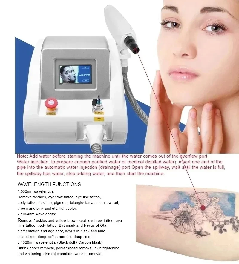 Máquina de belleza láser portátil q-switch ND YAG, eliminación de tatuajes, eliminación de pigmentación, Peeling de carbono, los más vendidos