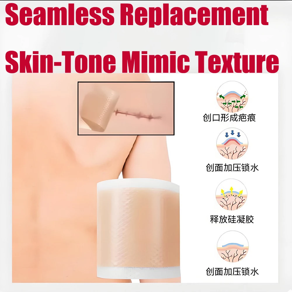 4 سنتيمتر * 50 سنتيمتر ندبة ورقة إزالة قطاع الطفل الأذن مصحح هلام السيليكون ندبة التصحيح قطاع لحب الشباب كيلويد جراحة حرق العلاج #1