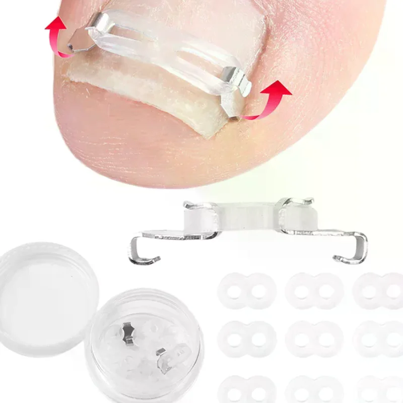 

1/2 Set Ingrown Toenail Corrector Tools Pedicure Recover Embed Toenail Treatment Professional Foot Care Correction Tool