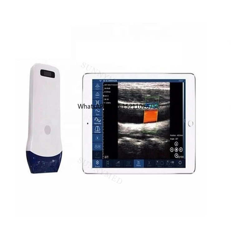 SY-5L Portable Medical Color Doppler Probe Pocket Wireless Wi-Fi Ultrasound Machine wireless ultrasound scanner