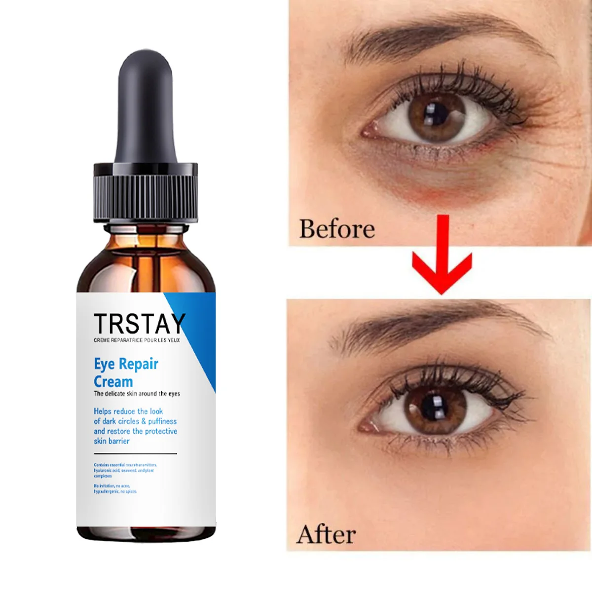 

Крем для восстановления глаз TRSTAY уменьшает темные круги, отечность, восстанавливает защитный барьер для кожи, уход за лицом для мам и детей