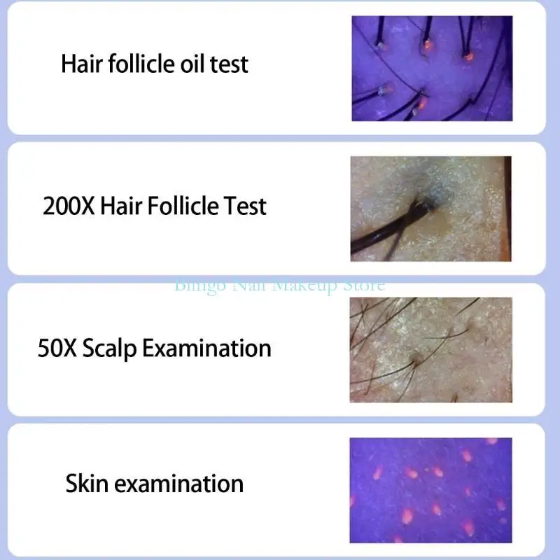 28TA محلل جلد فروة الرأس متعدد الوظائف مع اتصال واي فاي كاميرا عالية الوضوح للعناية بفروة الرأس تكبير 50x-200x #5