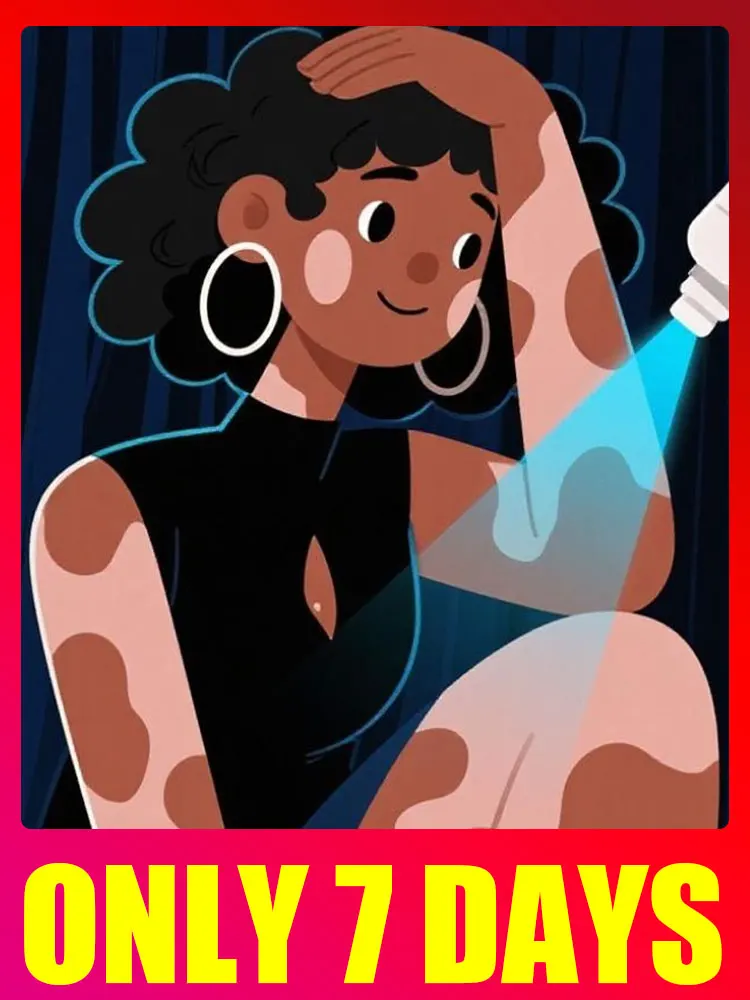 New Blue Laser Says Goodbye To Vitiligo